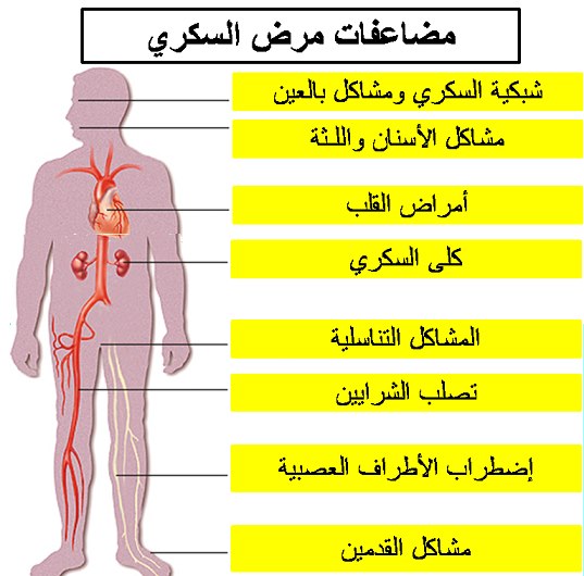 صور مضاعفات مرض السكر