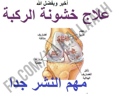 علاج الخشونة بالاعشاب