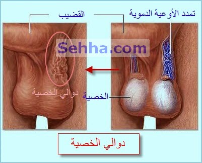 حبوب صغيرة على الخصيه