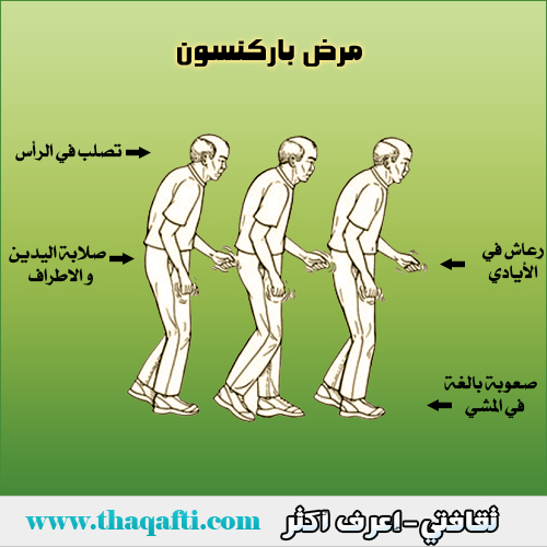 عدم اتزان في المشي