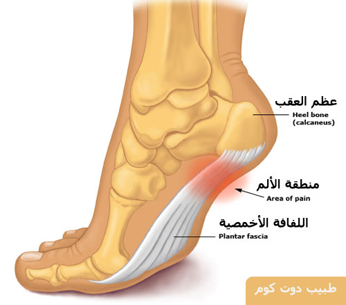 اسباب الم القدم