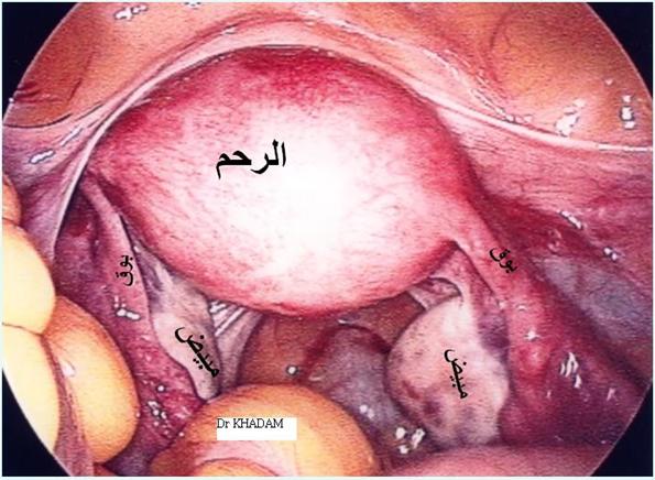 ماهي علامات تعشيش البويضة الملقحة داخل جدار الرحم