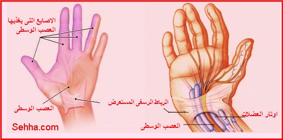 ما سبب الاحساس بوخز في الثدي الايسر