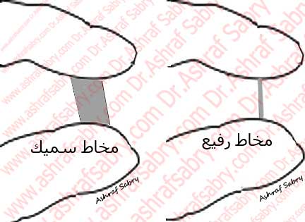 اسباب كثرة الافرازات